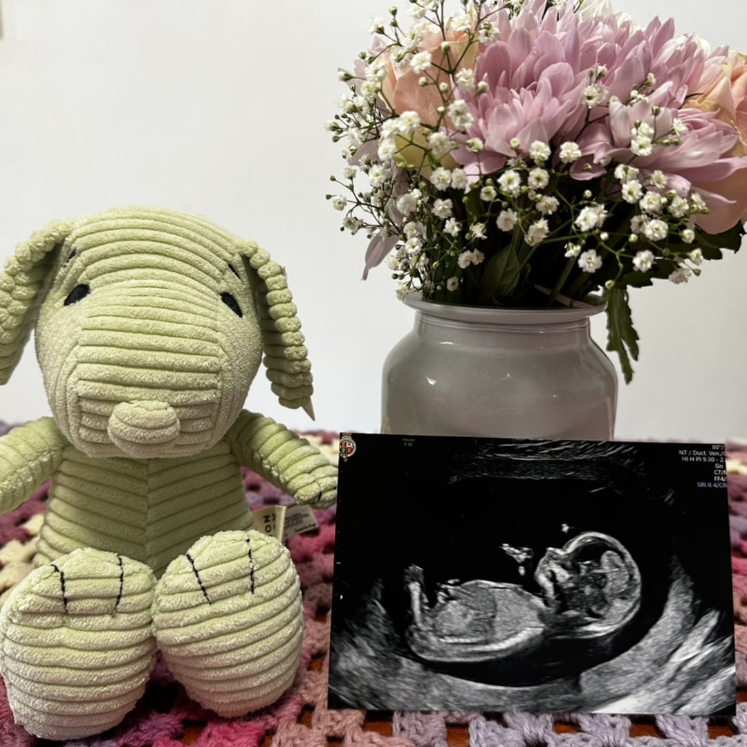 Photo shared by Bernie and Lucy for their Babylist baby registry.