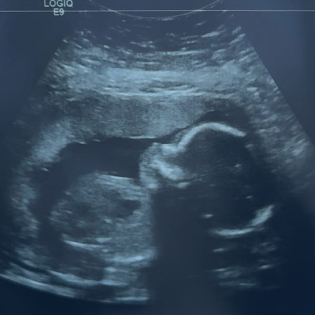 Photo shared by Skyler for their Babylist baby registry.