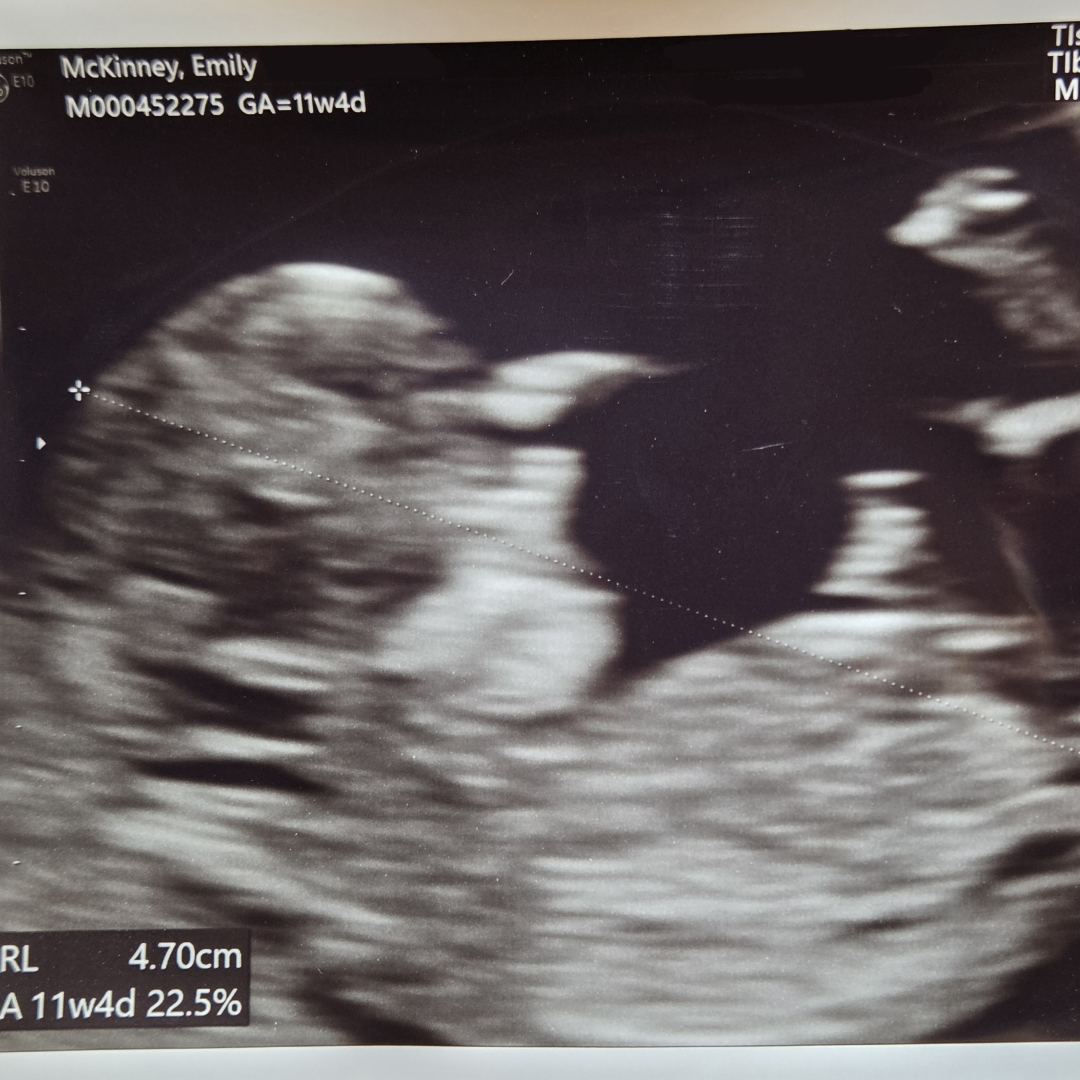 Photo shared by Emily for their Babylist baby registry.