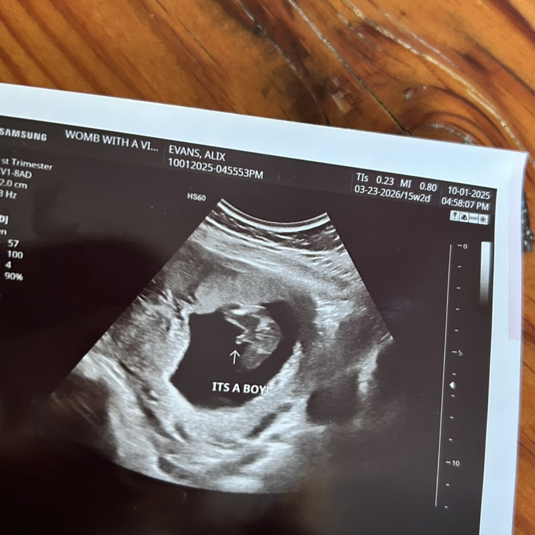 Photo shared by Alix for their Babylist baby registry.