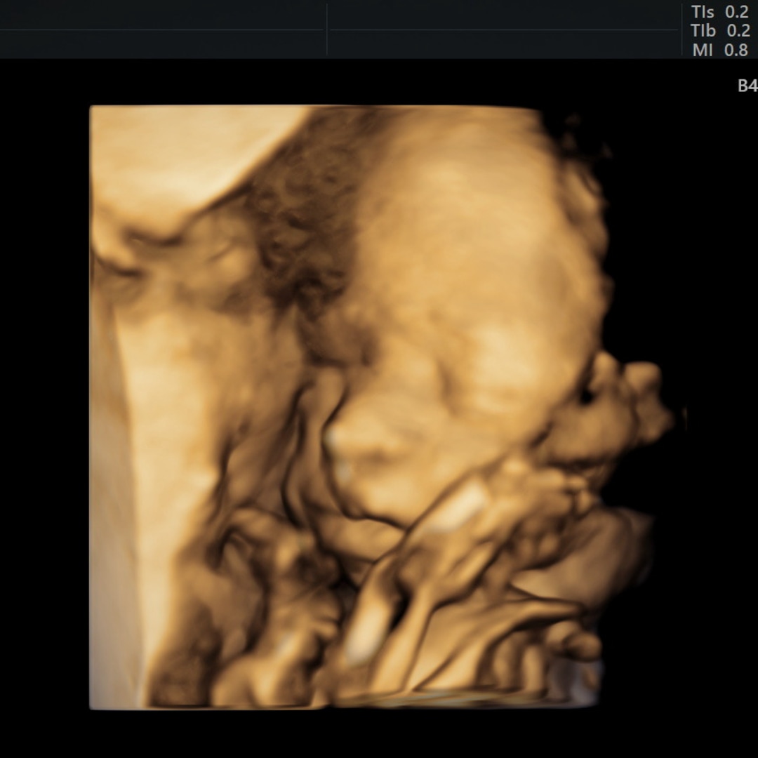 Photo shared by Dennisha for their Babylist baby registry.