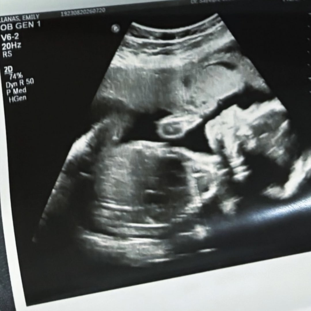 Photo shared by Emily for their Babylist baby registry.