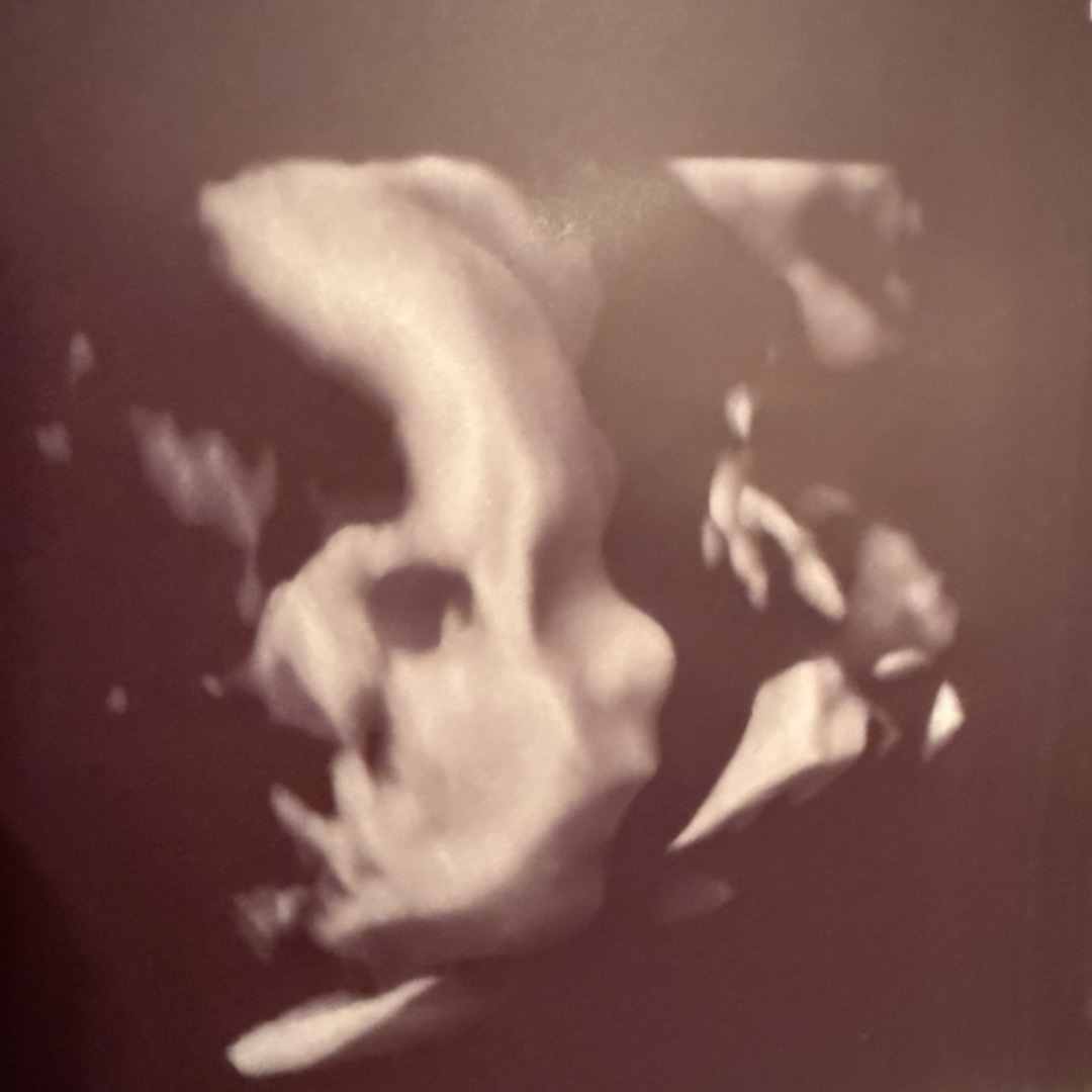 Photo shared by Chelsea for their Babylist baby registry.