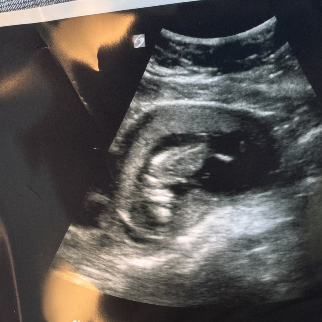 Photo shared by Elizabeth for their Babylist baby registry.