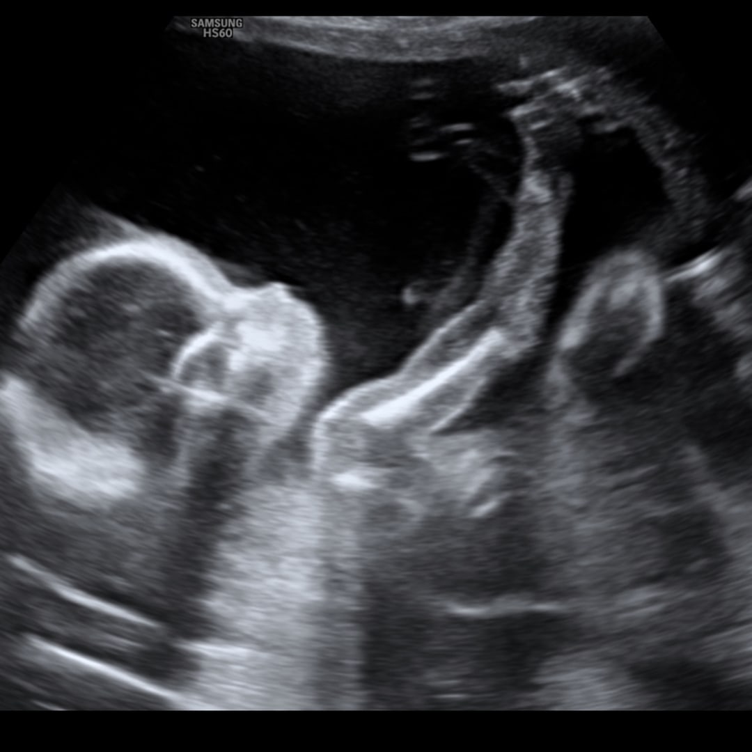 Photo shared by Andrea for their Babylist baby registry.