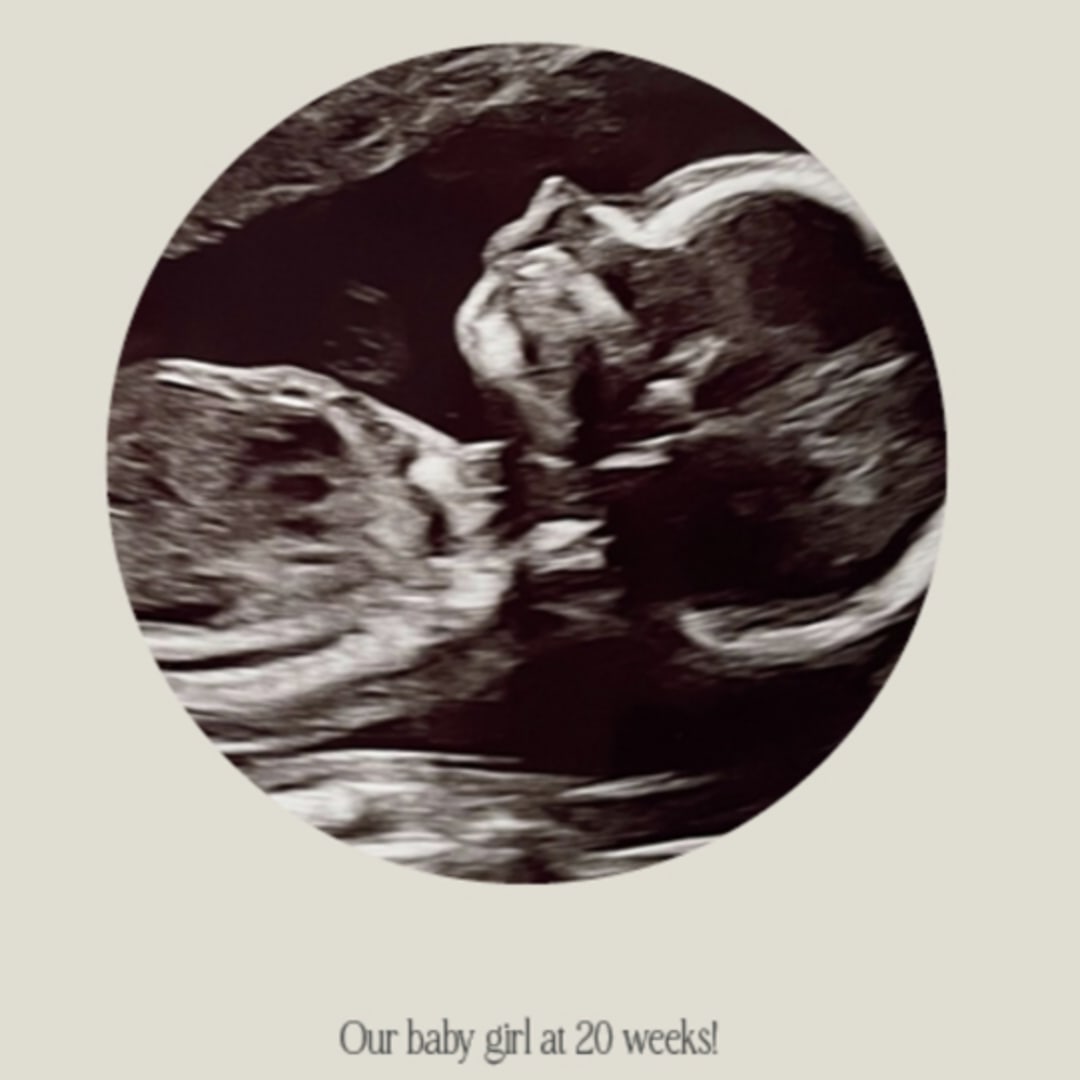 Photo shared by Lesley for their Babylist baby registry.
