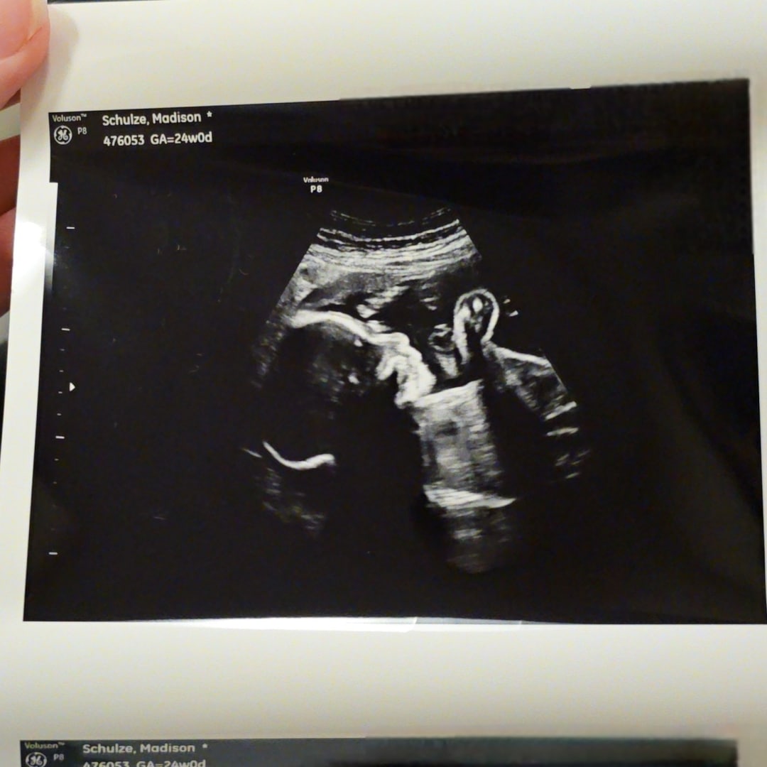Photo shared by Madison for their Babylist baby registry.