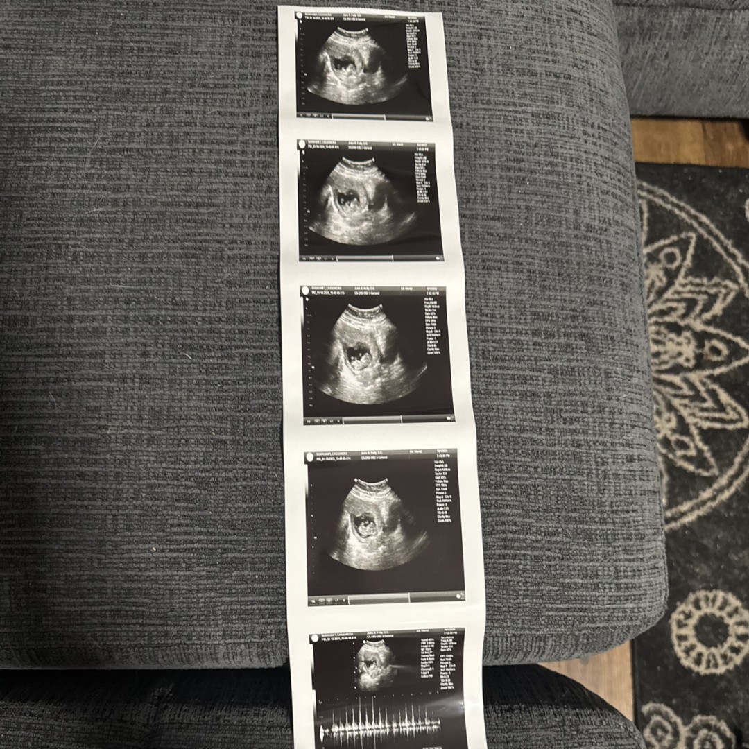 Photo shared by Cassandra for their Babylist baby registry.