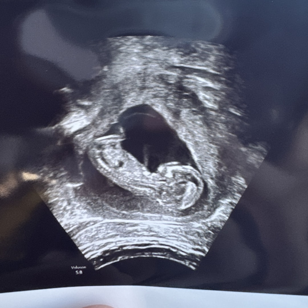 Photo shared by Bianca for their Babylist baby registry.