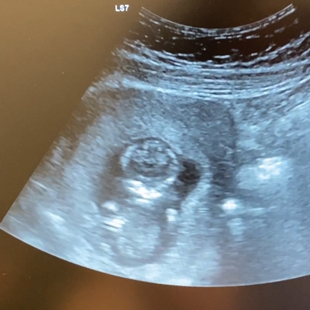 Photo shared by Emily for their Babylist baby registry.