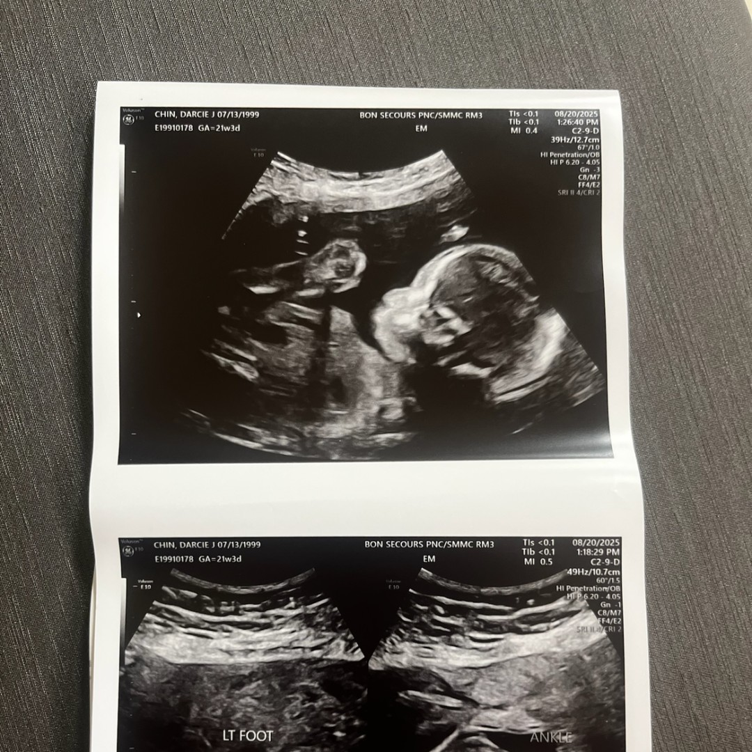 Photo shared by Darcie for their Babylist baby registry.
