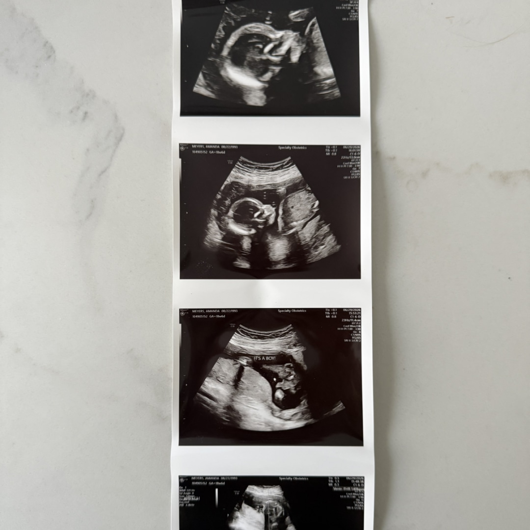 Photo shared by Amanda for their Babylist baby registry.