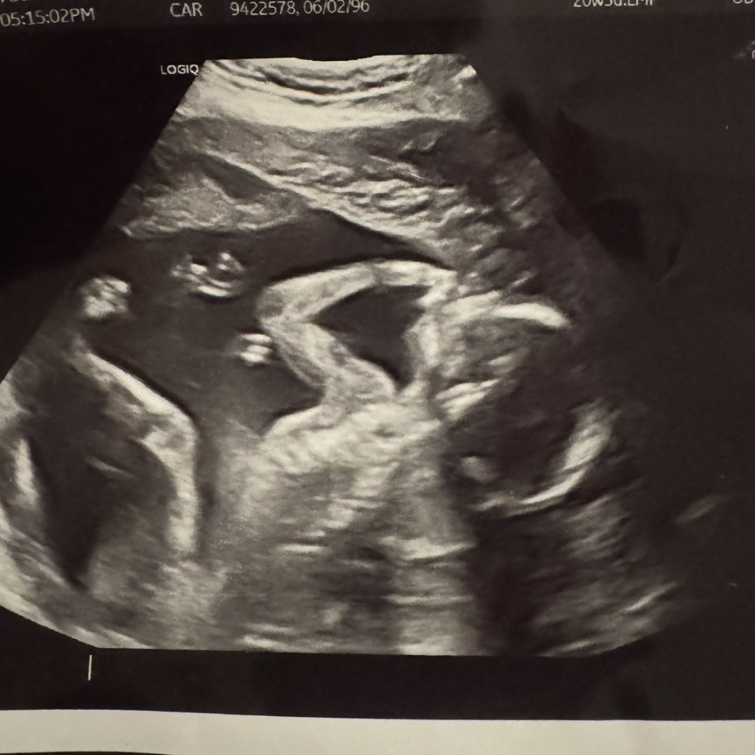 Photo shared by Sarah for their Babylist baby registry.