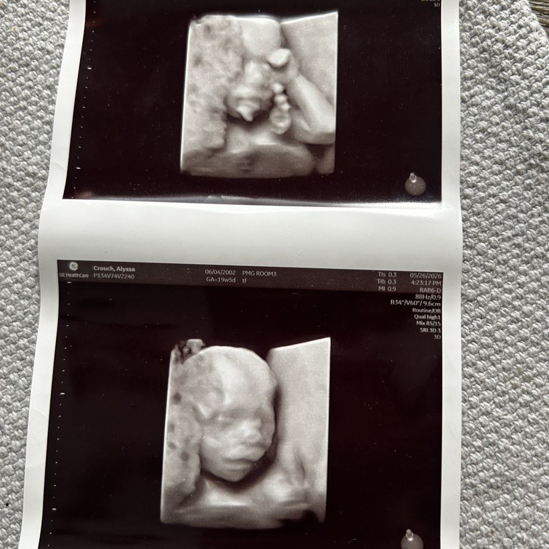 Photo shared by Alyssa for their Babylist baby registry.