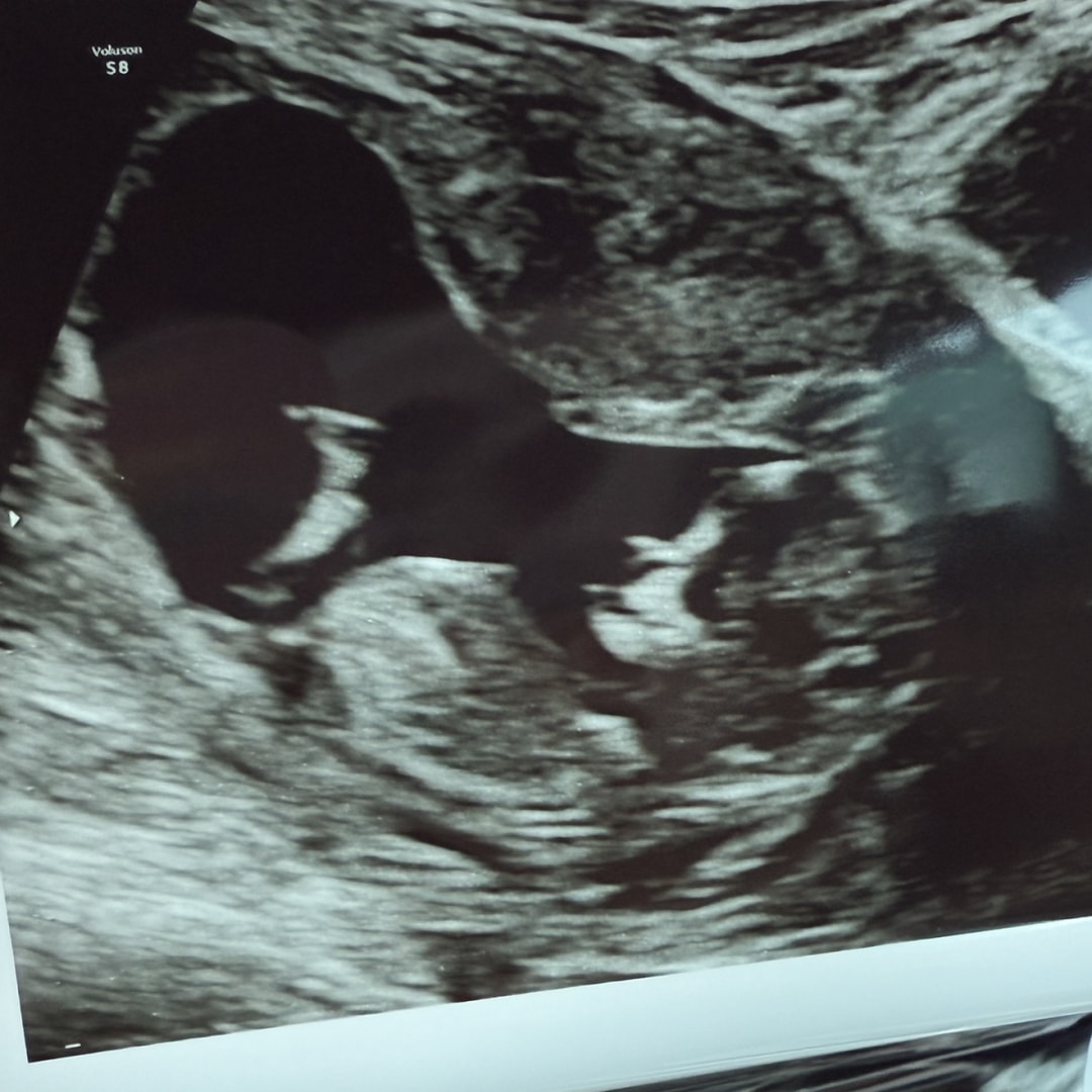 Photo shared by Alexia for their Babylist baby registry.