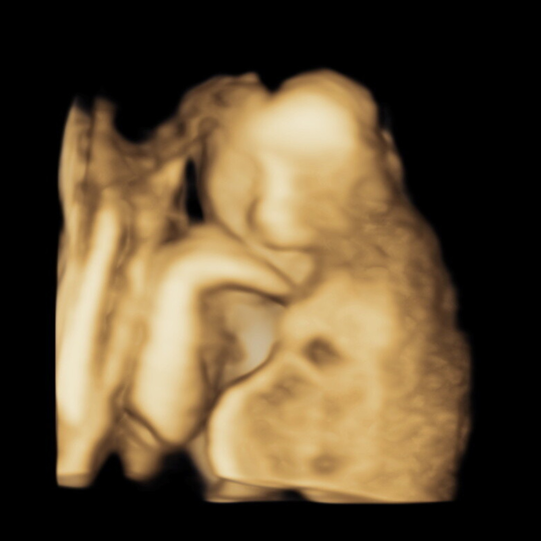 Photo shared by Angela for their Babylist baby registry.