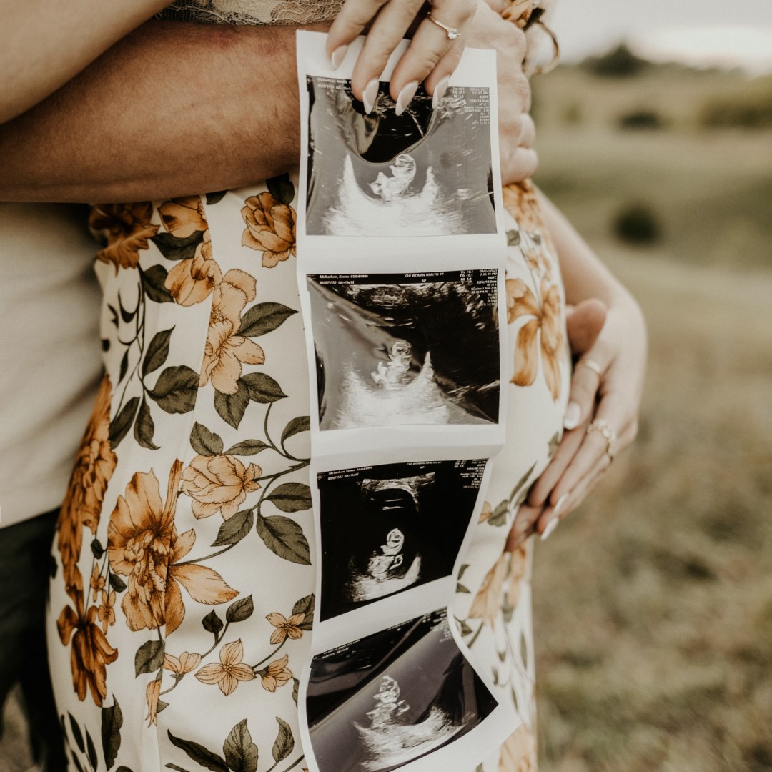 Photo shared by Kenna for their Babylist baby registry.