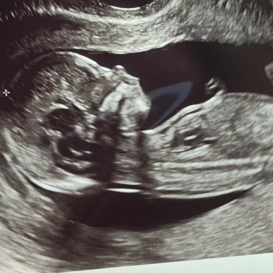 Photo shared by Ashley for their Babylist baby registry.
