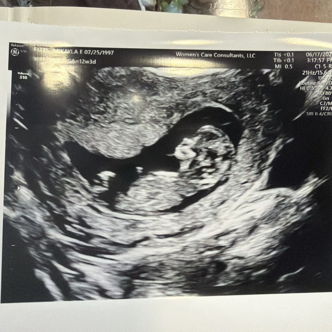 Photo shared by Kayla for their Babylist baby registry.