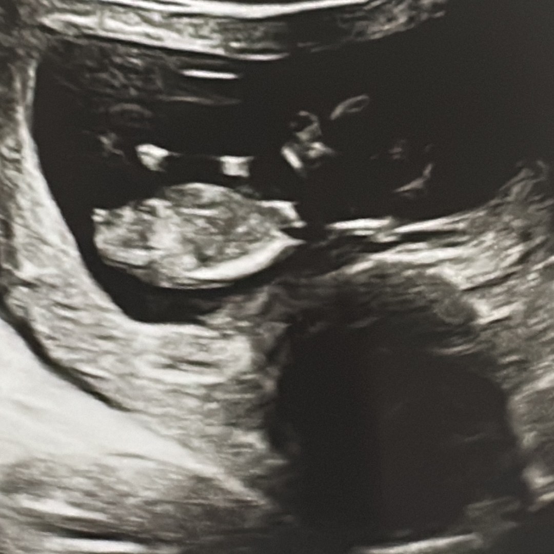 Photo shared by Jeidi for their Babylist baby registry.