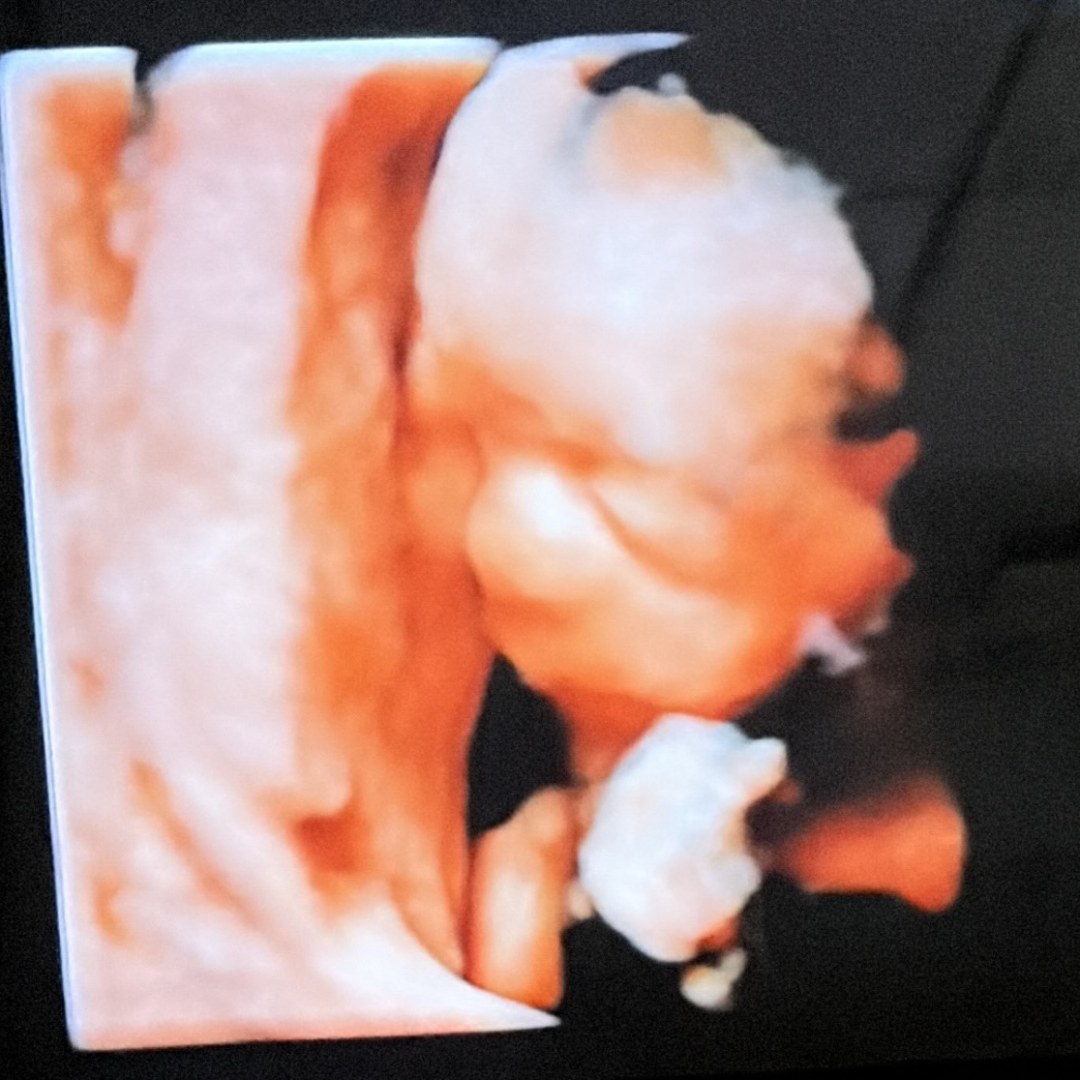 Photo shared by Alyna for their Babylist baby registry.