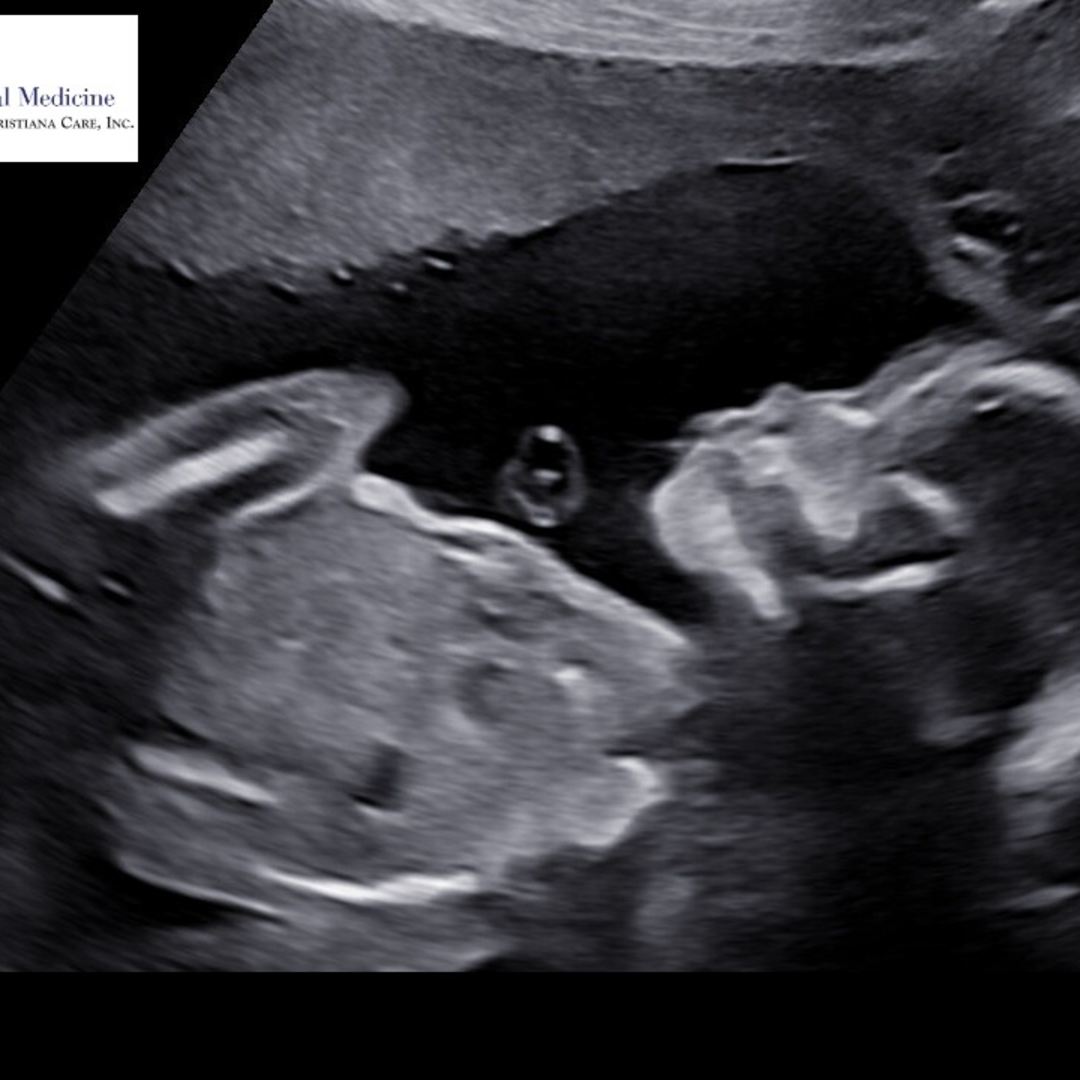 Photo shared by Ashley for their Babylist baby registry.