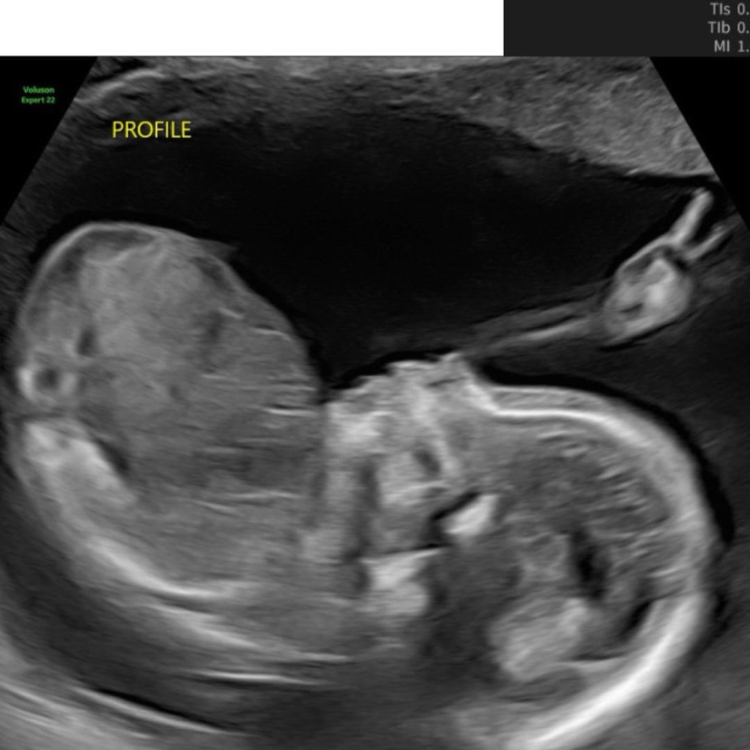 Photo shared by Gabbie for their Babylist baby registry.