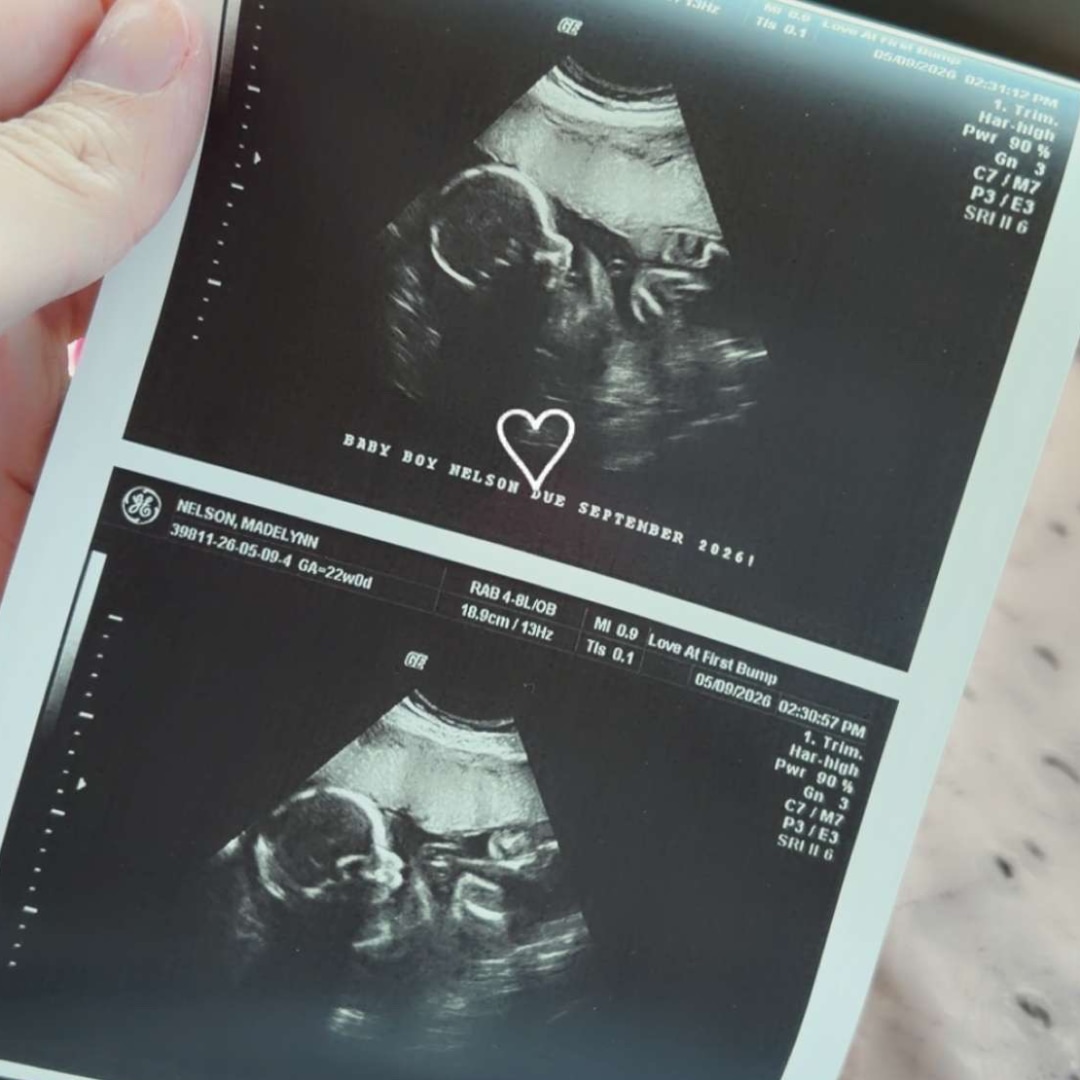 Photo shared by Madelynn for their Babylist baby registry.