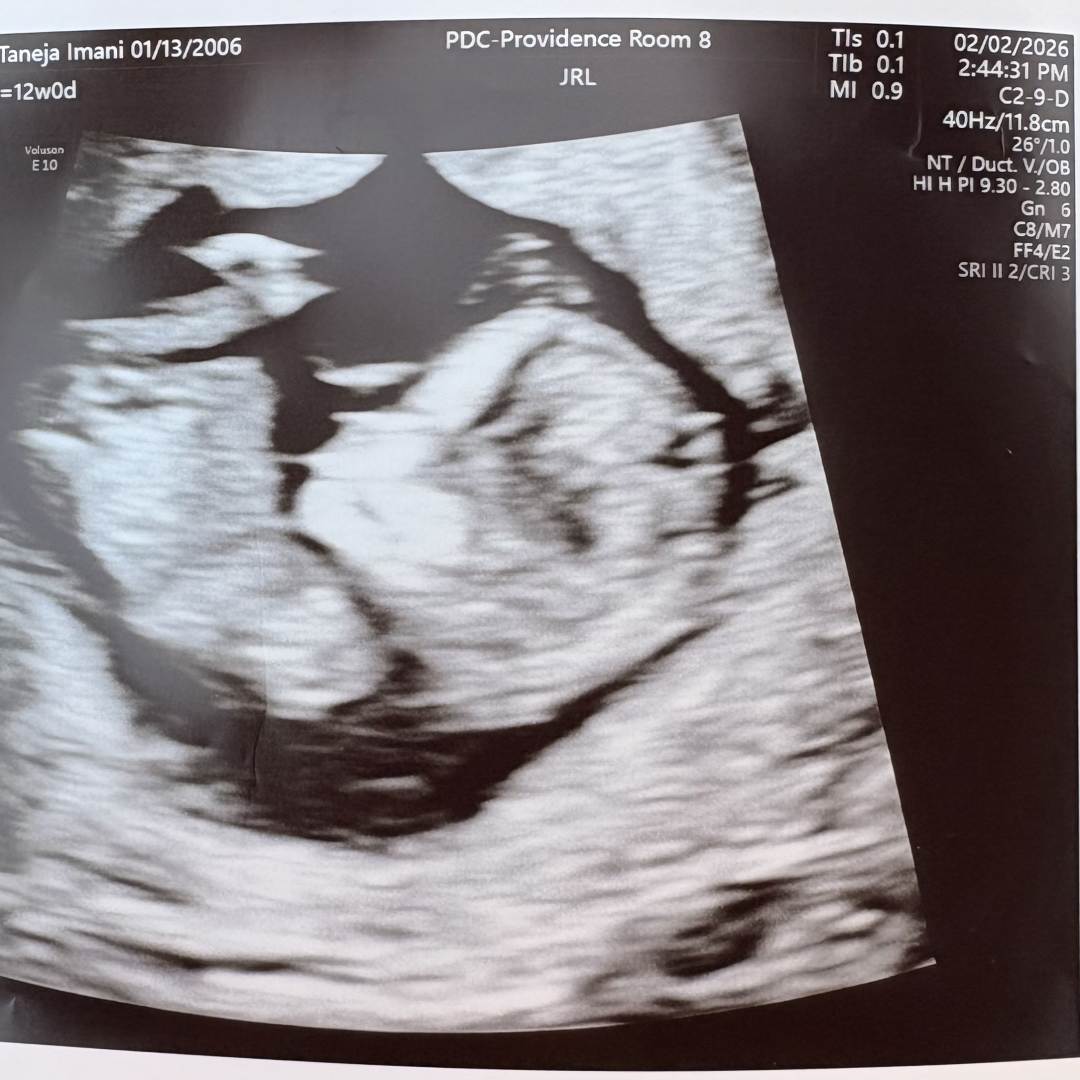 Photo shared by Tanéja for their Babylist baby registry.