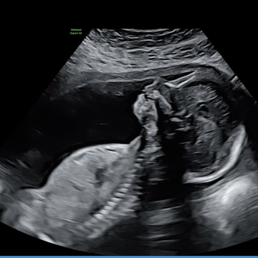 Photo shared by Peydon for their Babylist baby registry.