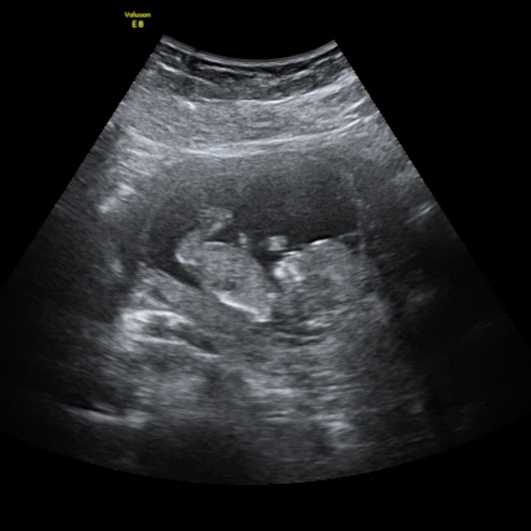 Photo shared by Kelby for their Babylist baby registry.