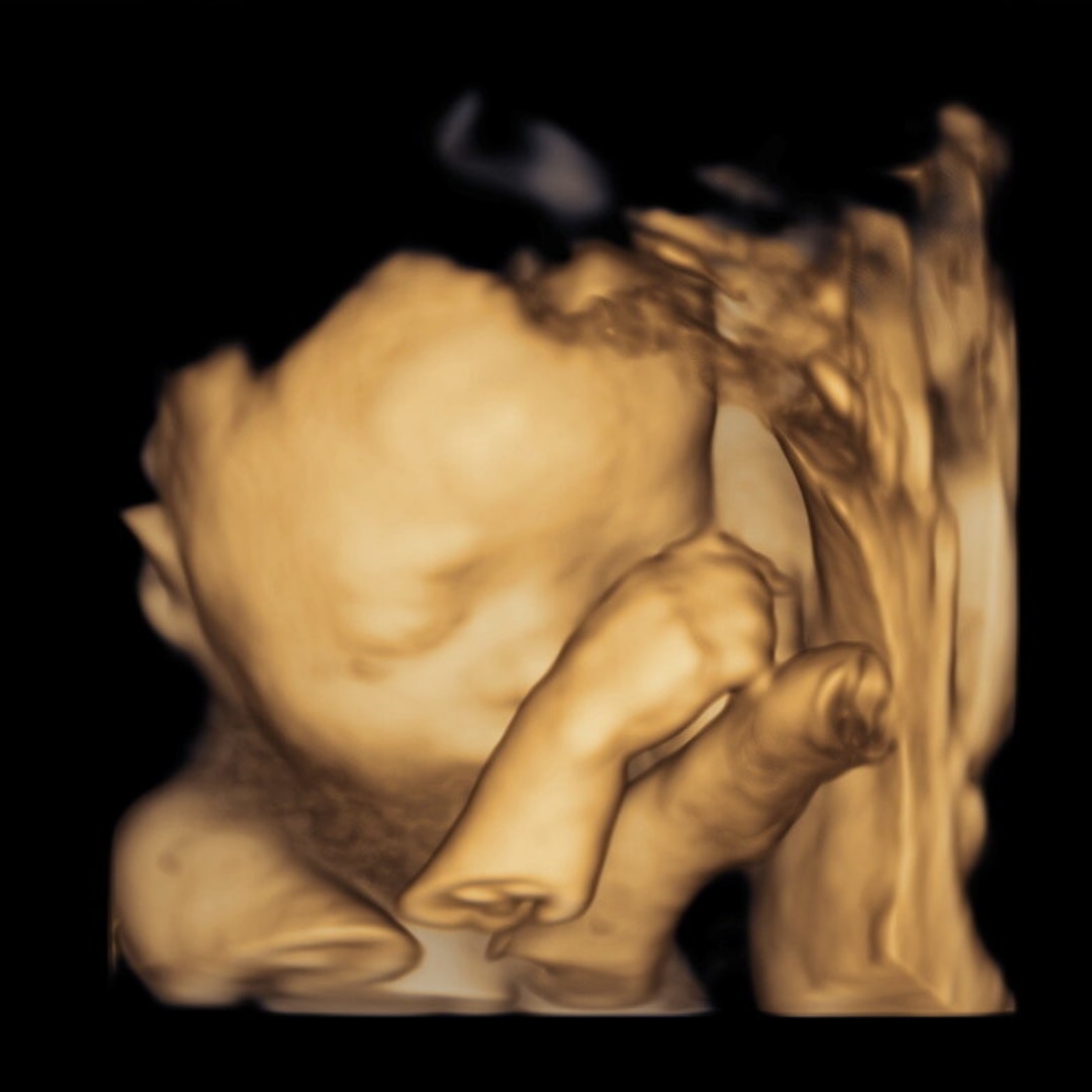 Photo shared by Grace for their Babylist baby registry.