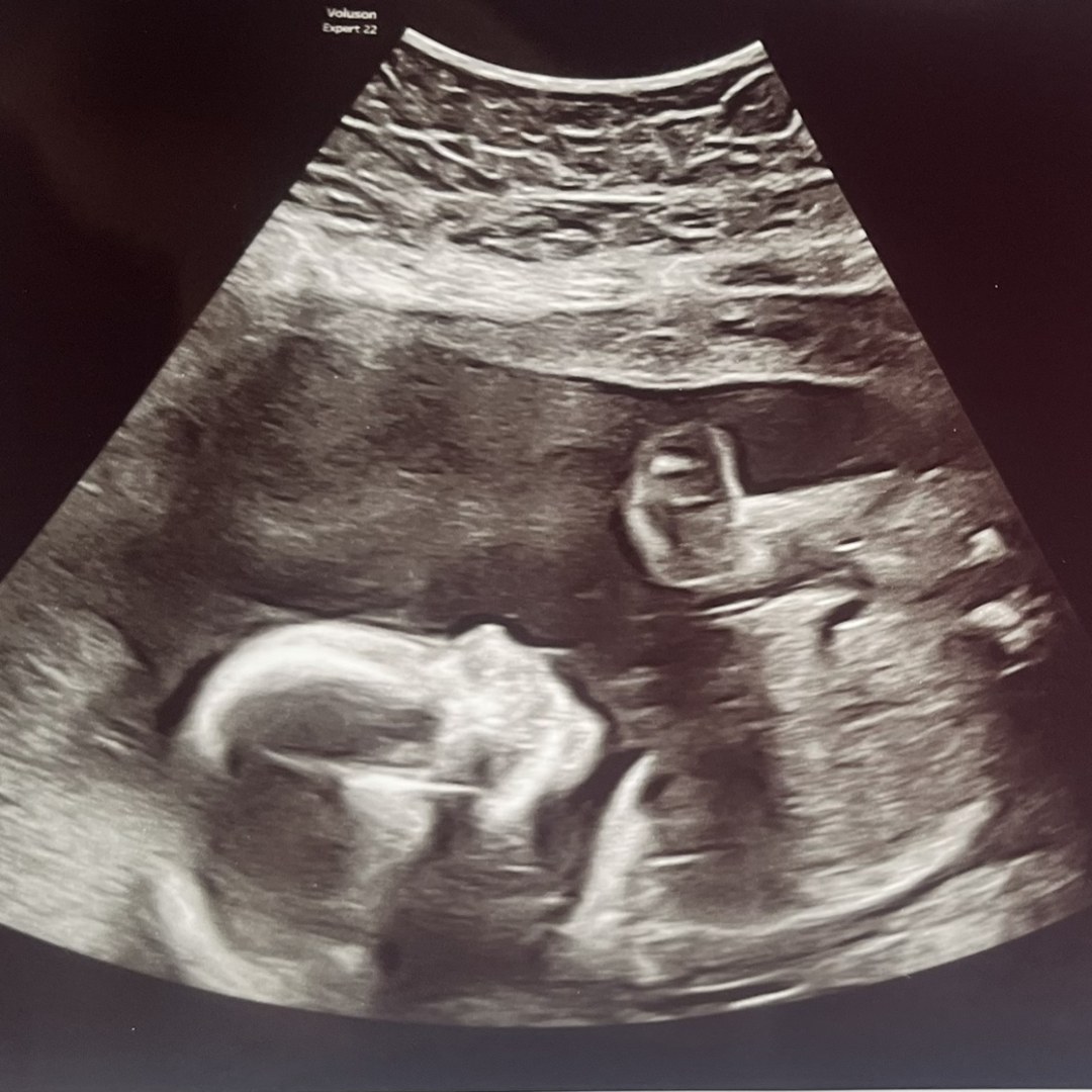 Photo shared by Heather for their Babylist baby registry.