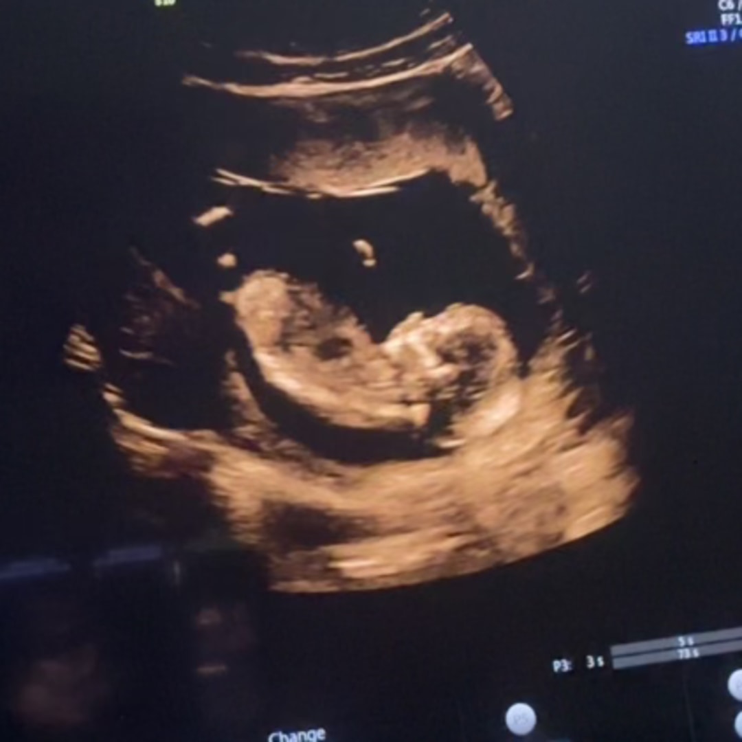 Photo shared by Emylie for their Babylist baby registry.