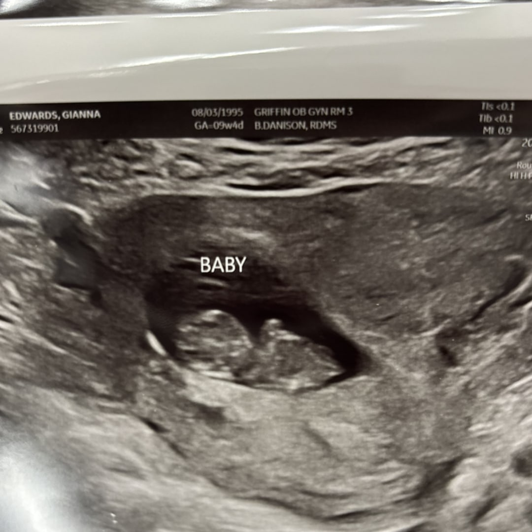 Photo shared by Gianna for their Babylist baby registry.