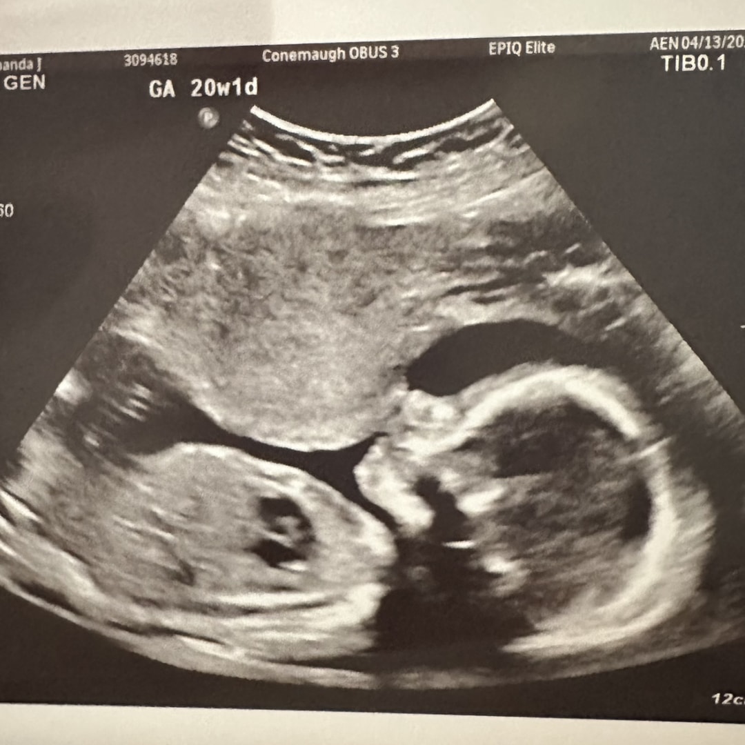 Photo shared by Amanda for their Babylist baby registry.