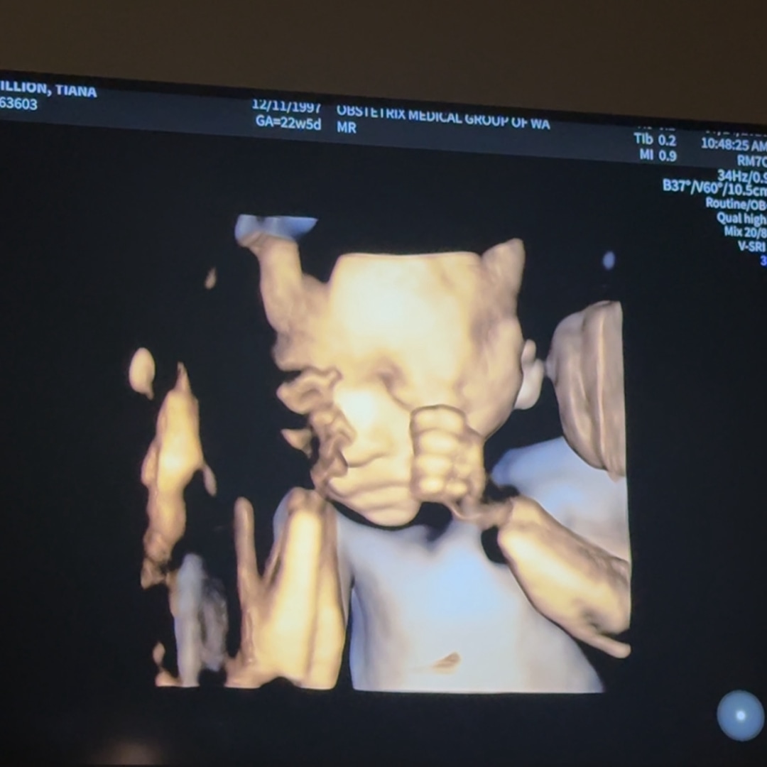 Photo shared by Zhanna for their Babylist baby registry.