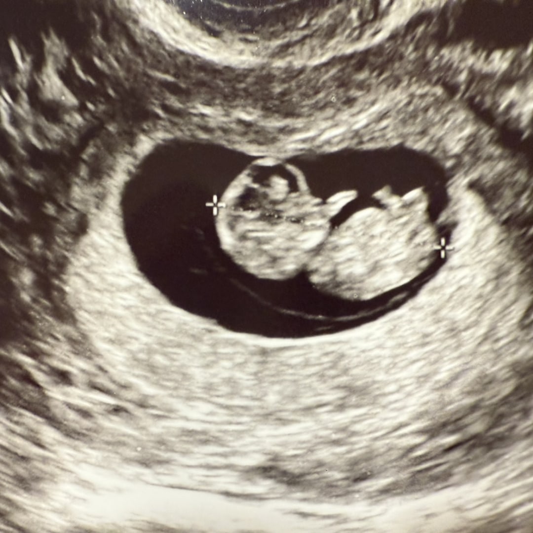 Photo shared by Hannah for their Babylist baby registry.