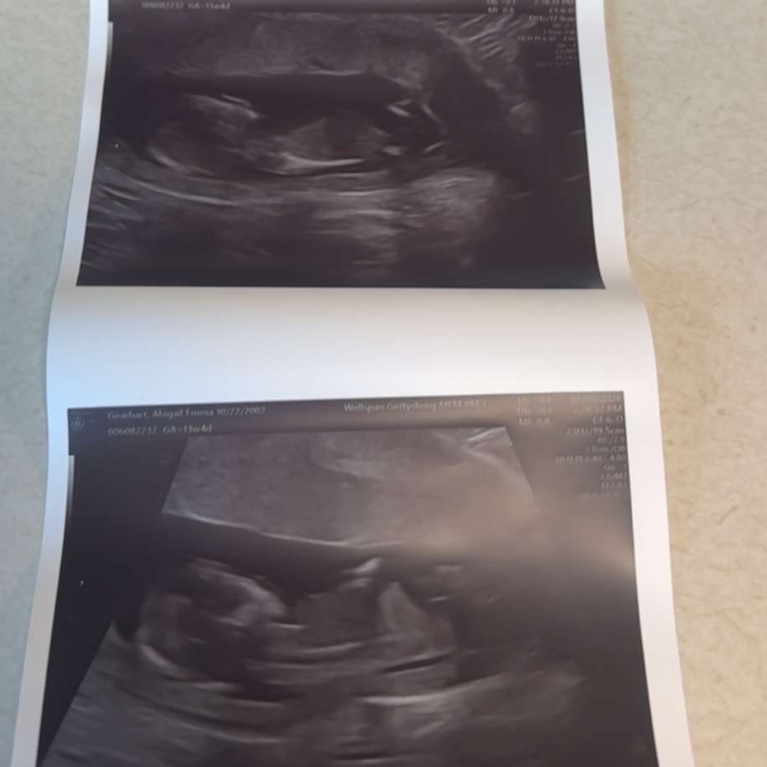 Photo shared by Abigail for their Babylist baby registry.