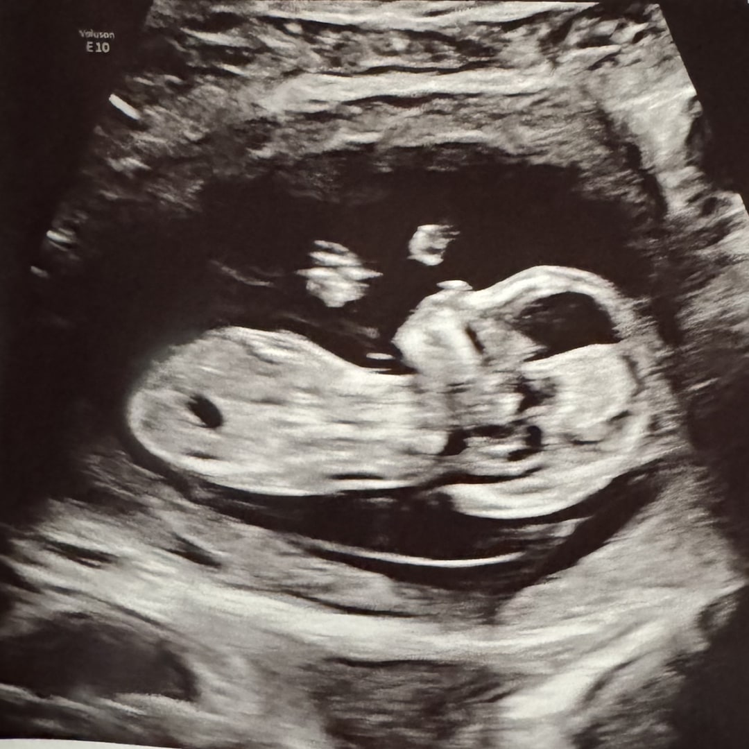 Photo shared by CJ for their Babylist baby registry.