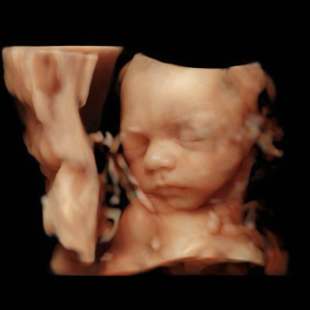 Photo shared by Rebecca for their Babylist baby registry.