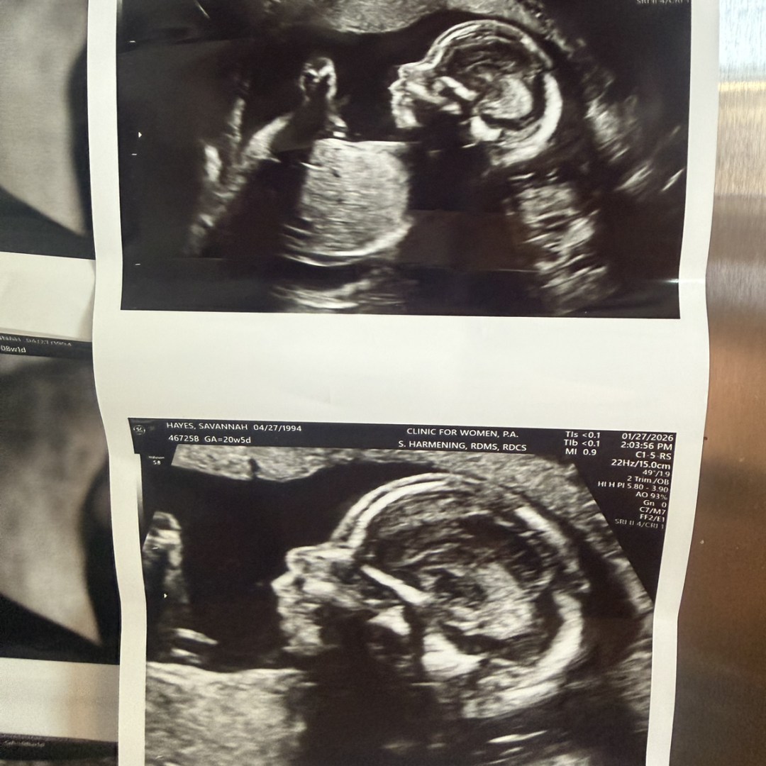 Photo shared by Savannah for their Babylist baby registry.