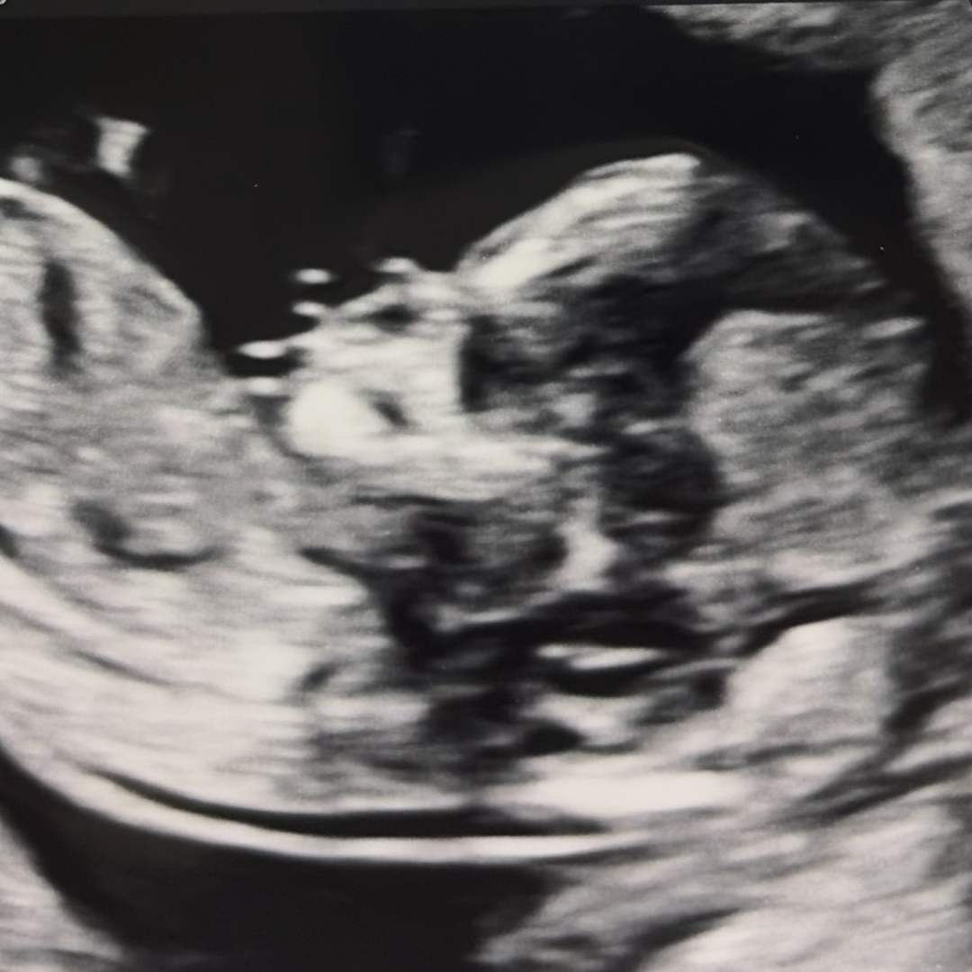Photo shared by Erin for their Babylist baby registry.