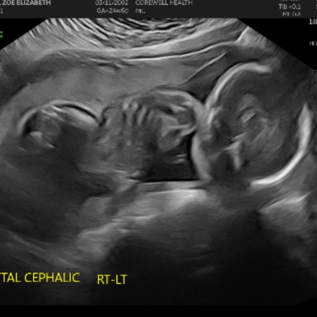 Photo shared by Zoe for their Babylist baby registry.