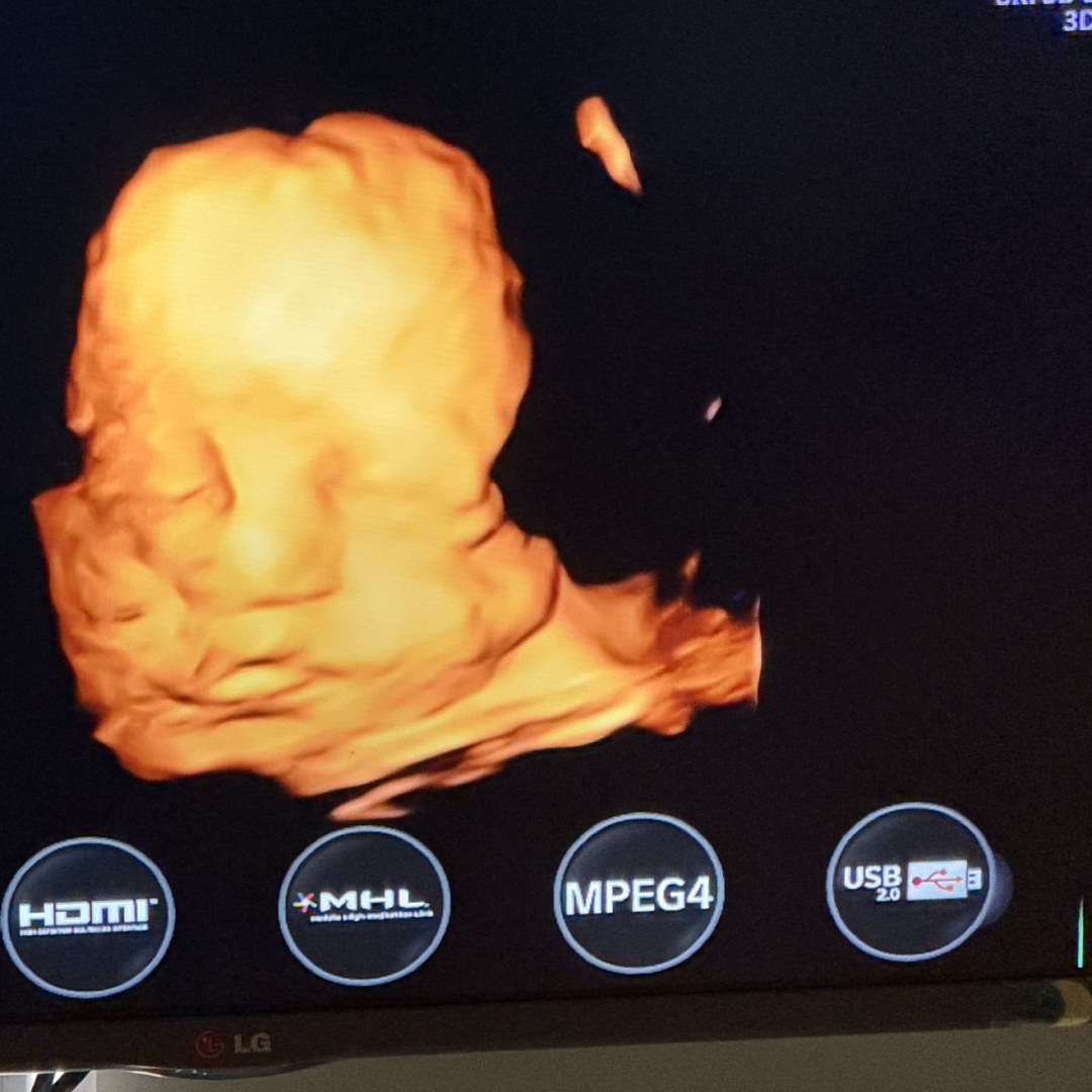 Photo shared by Andreina for their Babylist baby registry.