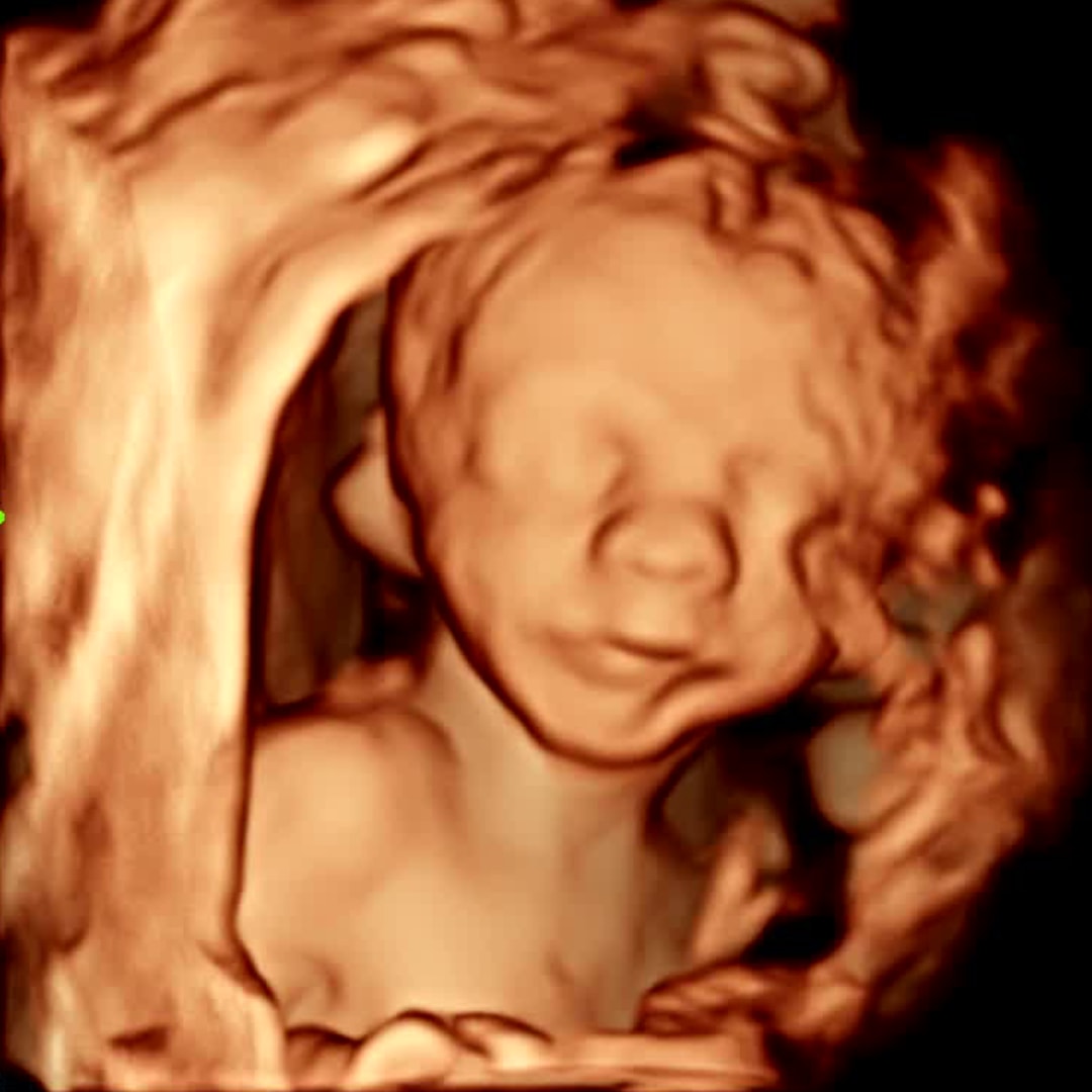 Photo shared by Lainey for their Babylist baby registry.