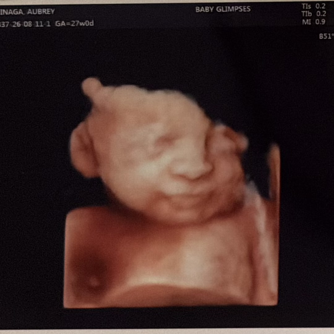 Photo shared by Aubrey for their Babylist baby registry.