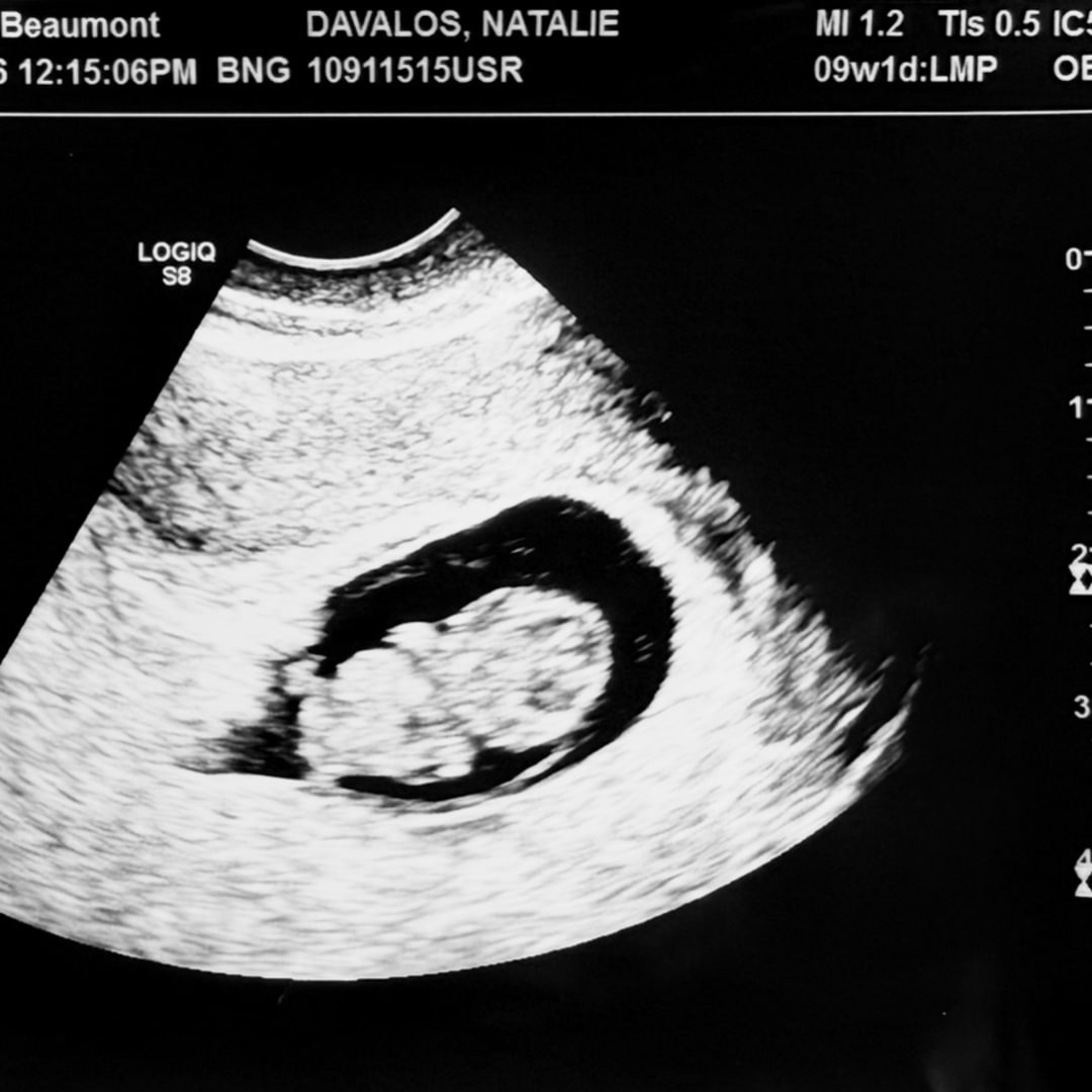 Photo shared by Natalie for their Babylist baby registry.