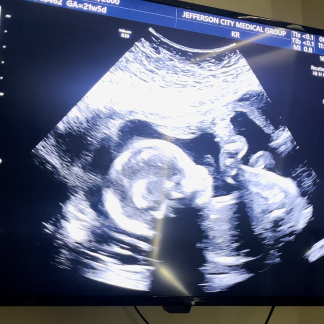 Photo shared by Kylee for their Babylist baby registry.