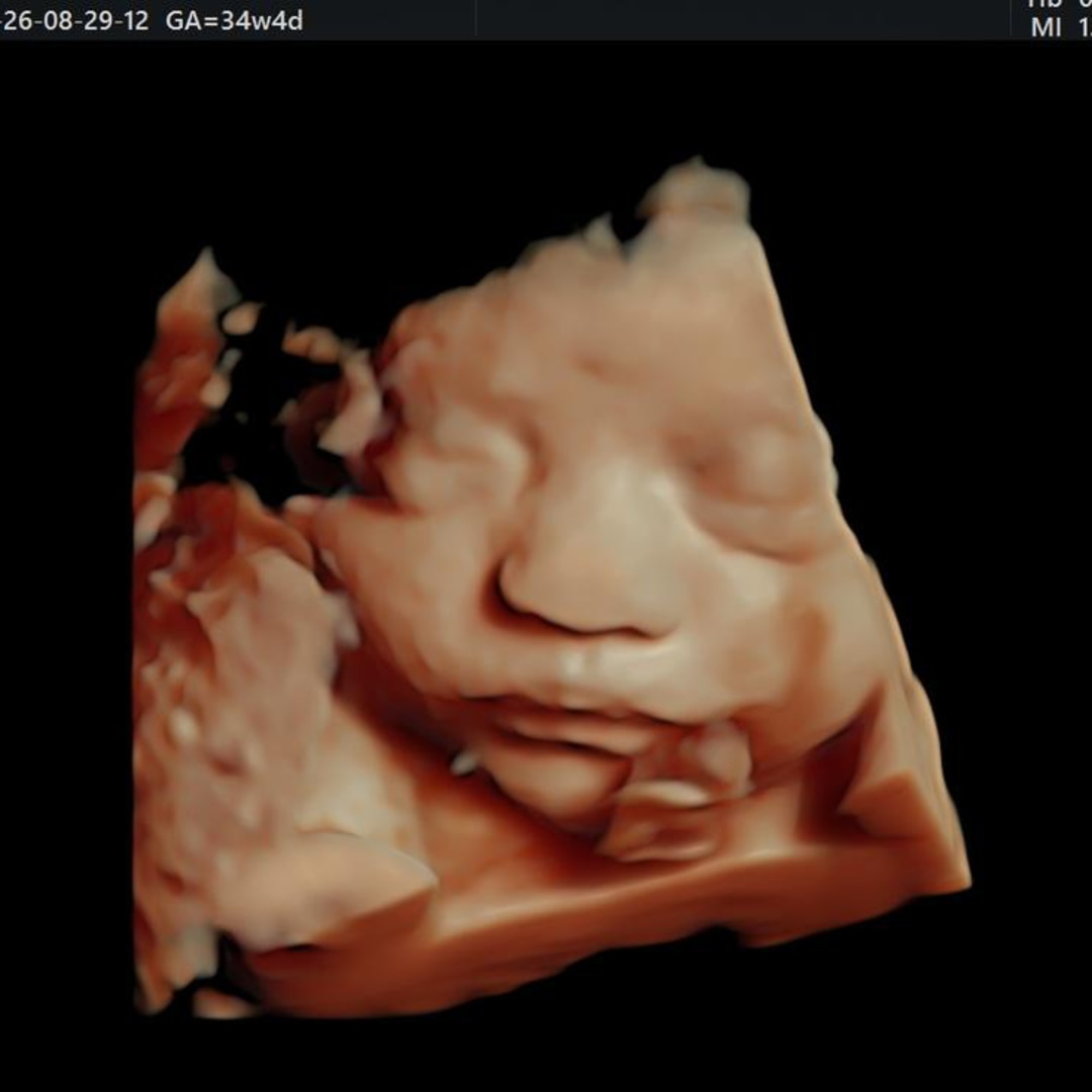 Photo shared by Alexis for their Babylist baby registry.